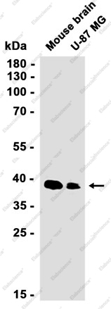 Recombinant SIRT2 Monoclonal Antibody - 2