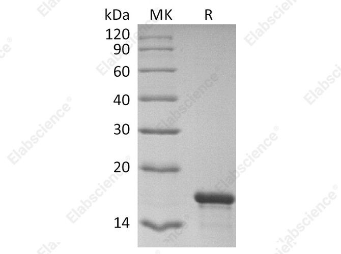Recombinant SARS-CoV-2 NP NTD domain (His Tag) - 1
