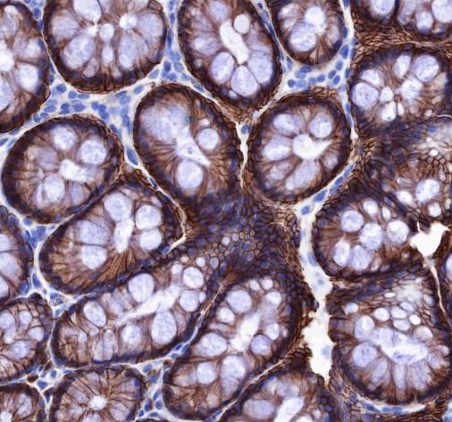 Recombinant Non-Phospho (Active) β-Catenin (Ser33, Ser37, Thr41) Monoclonal Antibody - 3