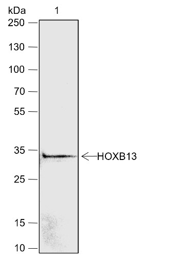 Recombinant HOXB13 Monoclonal Antibody - 2