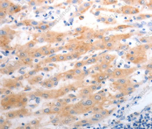 SLC22A6 Polyclonal Antibody - 3