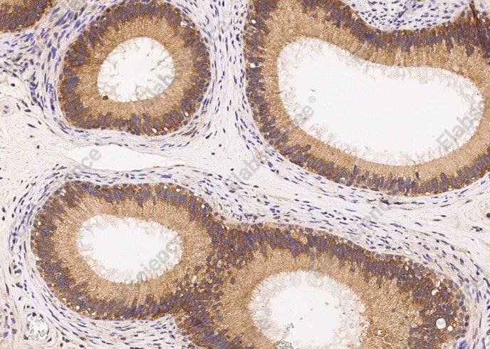 ERN1/IRE1 Monoclonal Antibody - 3