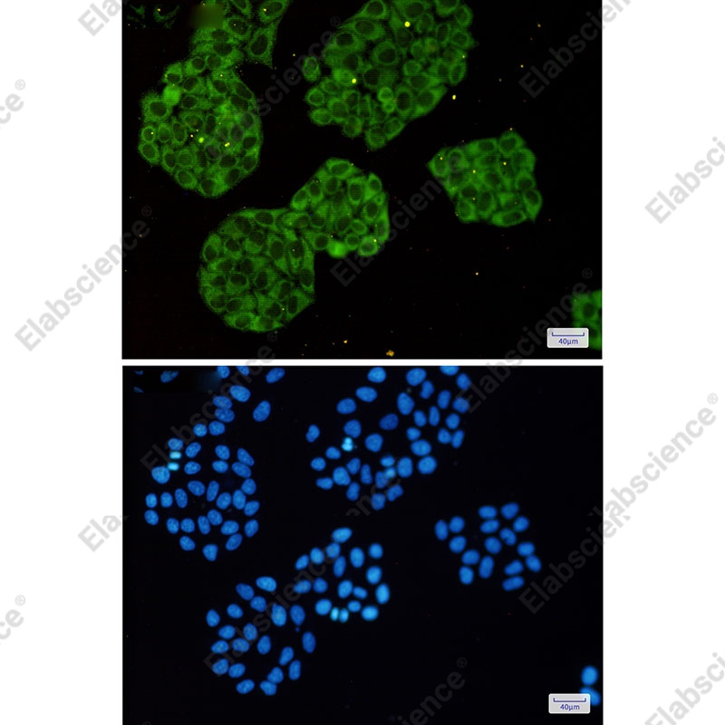 Recombinant MARS Monoclonal Antibody - 2