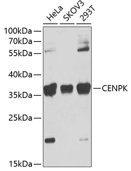 Western blot analysis of extracts of various cell lines using CENPK Polyclonal Antibody at 1:1000 dilution.