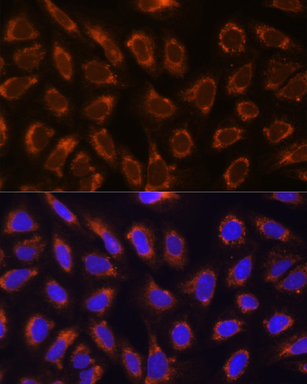 Immunofluorescence analysis of U-2 OS cells using GANAB Polyclonal antibody at dilution of 1:100. Blue: DAPI for nuclear staining.