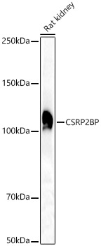 Western blot analysis of extracts of various cell lines using CSRP2BP Polyclonal Antibody at 1:1000 dilution.