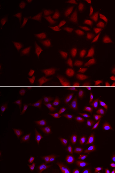 Immunofluorescence analysis of HeLa cells using CIRBP Polyclonal Antibody
