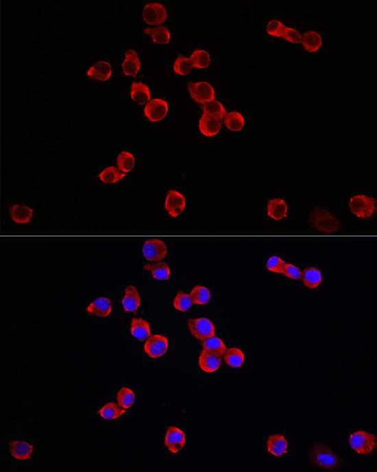 Immunofluorescence analysis of Neuro-2a cells using TrkB Polyclonal Antibody at dilution of 1:100 (40x lens). Blue: DAPI for nuclear staining.