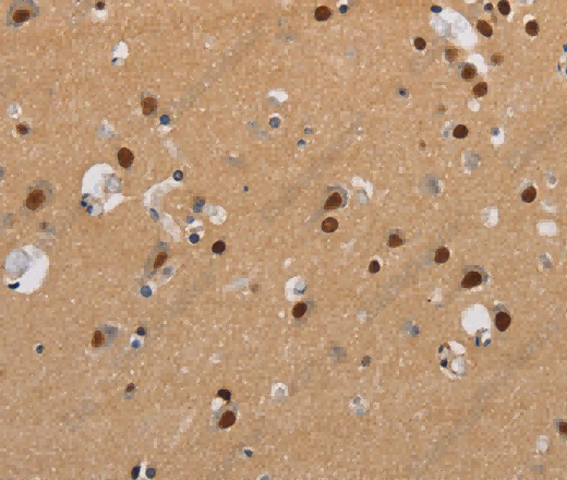 KCNG4 Polyclonal Antibody - 3
