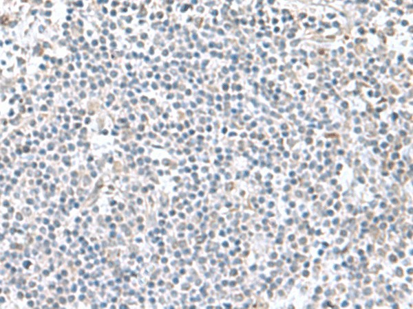 Immunohistochemistry of paraffin-embedded Human tonsil tissue  using PAM16 Polyclonal Antibody at dilution of 1:60(?200)