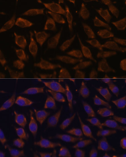 Immunofluorescence analysis of L929 cells using NOTCH2 Polyclonal Antibody at dilution of 1:100. Blue: DAPI for nuclear staining.