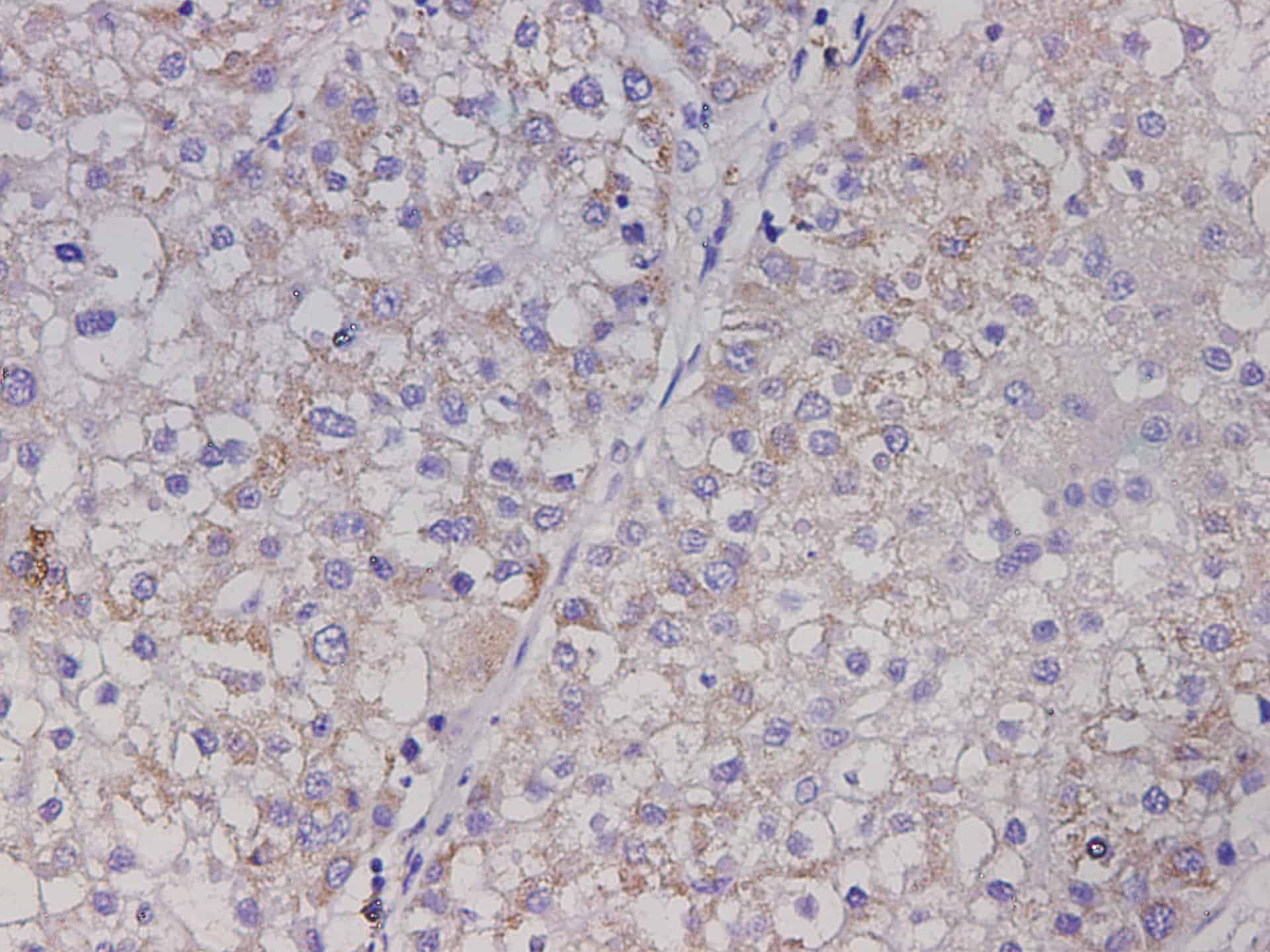 Immunohistochemistry of paraffin-embedded Mouse liver using AFP Polyclonal Antibody at dilution of 1:50