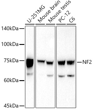 Western blot analysis of extracts of various cell lines using NF2 Polyclonal Antibody at 1:1000 dilution.