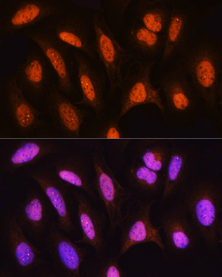 Immunofluorescence analysis of U2OS cells using HSPA2 Polyclonal Antibody at dilution of  1:100. Blue: DAPI for nuclear staining.