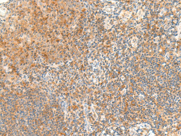 Immunohistochemistry of paraffin-embedded Human tonsil tissue  using RAPGEF1 Polyclonal Antibody at dilution of 1:45(?200)