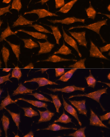 Immunofluorescence analysis of L929 cells using ABHD4 Polyclonal Antibody at dilution of 1:100. Blue: DAPI for nuclear staining.