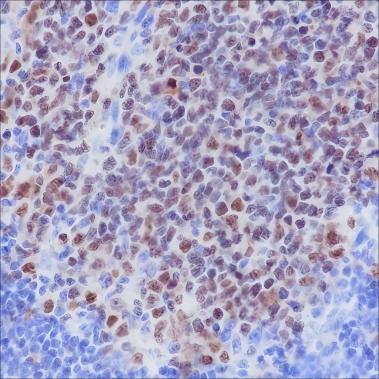 Recombinant BCL6 Monoclonal Antibody - small - 3