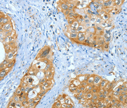 ANXA3 Polyclonal Antibody - 2