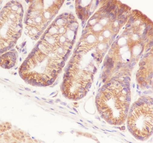 Recombinant NF-kB2 p100/p52 Monoclonal Antibody - small - 3