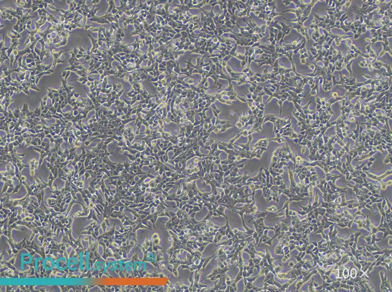 22RV1 Cell Complete Medium - 1