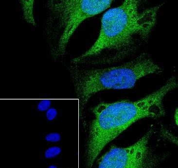 Recombinant Casein Kinase 1 gamma 2 Monoclonal Antibody-searchlist-2