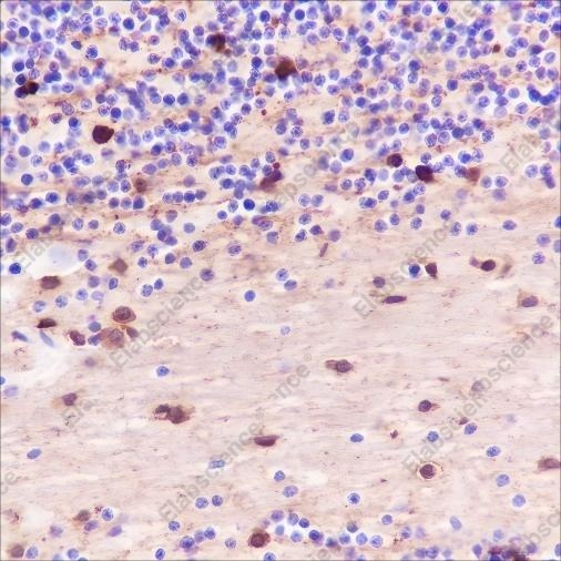 Recombinant Alpha B Crystallin Monoclonal Antibody - 2