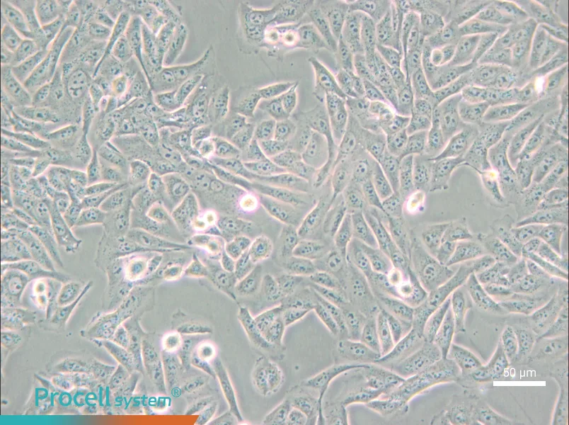 MNNG/HOS Cl #5 [R-1059-D] Cell Complete MediumMNNG/HOS Cl #5 [R-1059-D] Cell Complete Medium - 6