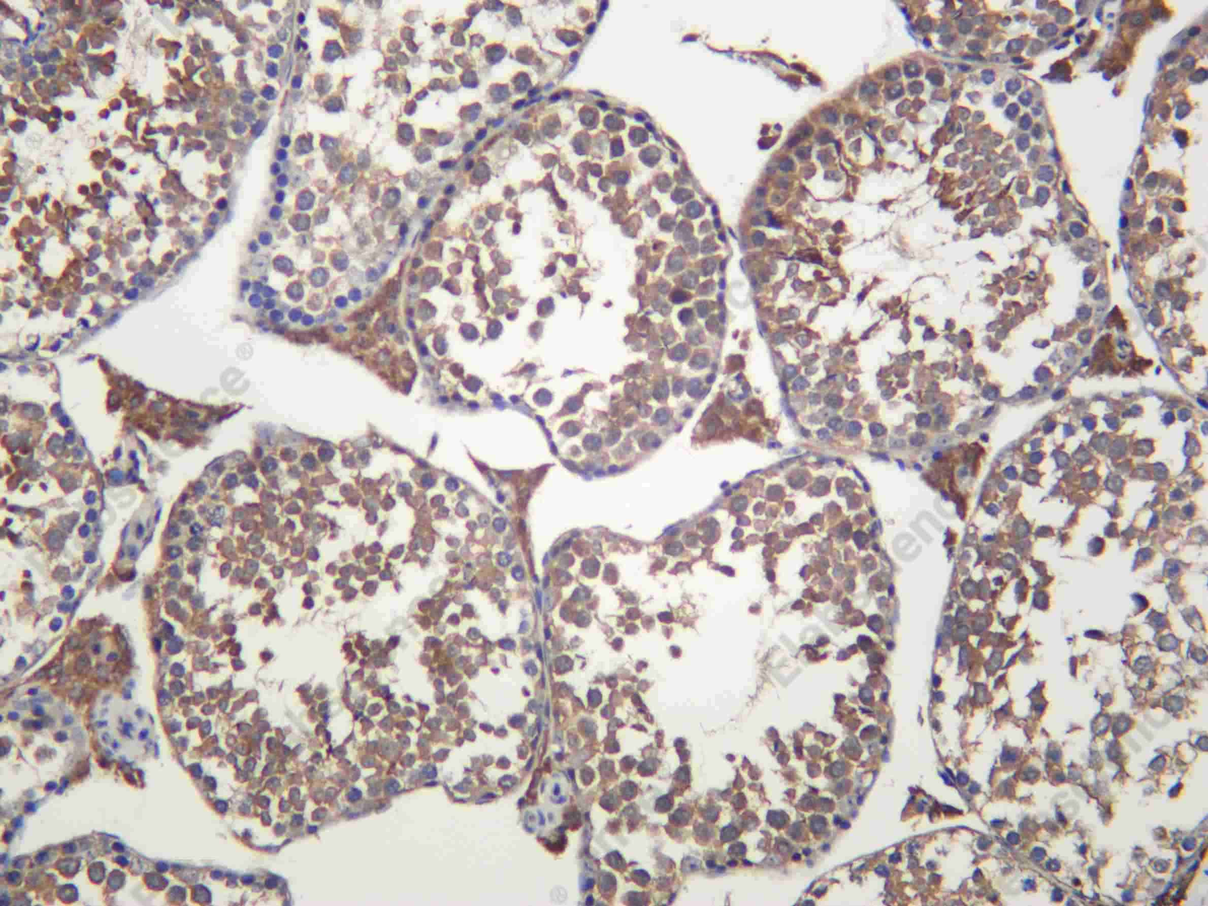 Recombinant CUL 2 Monoclonal Antibody - 2