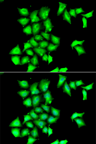 Immunofluorescence analysis of HeLa cells using MSRB1 Polyclonal Antibody