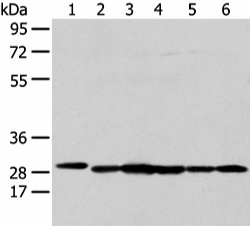 Western blot analysis of 293T HepG2 K562 and MCF-7 cell  using PRDX4 Polyclonal Antibody at dilution of 1:300