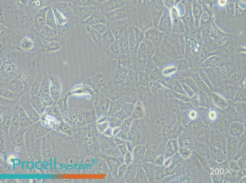 HCC-78 Cell Complete Medium - 5