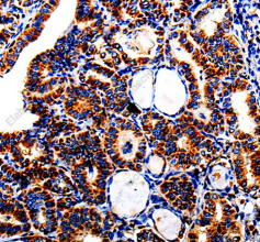 AFP Polyclonal Antibody - 2
