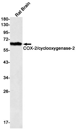 Western blot detection of COX-2/cyclooxygenase-2 in Rat Brain lysates using COX-2/cyclooxygenase-2 Rabbit mAb(1:500 diluted).Predicted band size:69kDa.Observed band size:69kDa.