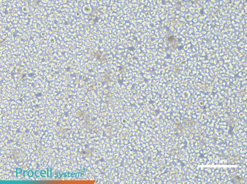 SET-2 Cell Complete MediumSET-2 Cell Complete Medium - 2