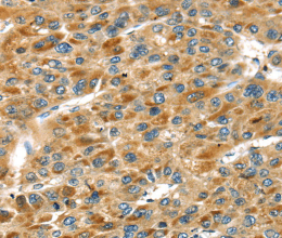 STX11 Polyclonal Antibody - 3