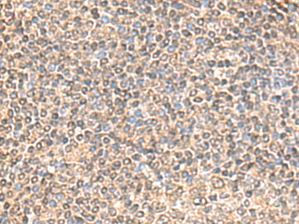 Immunohistochemistry of paraffin-embedded Human tonsil tissue  using IQCD Polyclonal Antibody at dilution of 1:60(?200)