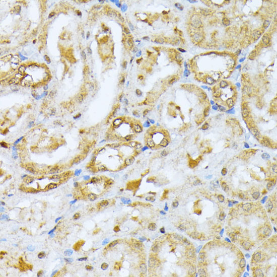 Immunohistochemistry of paraffin-embedded Rat kidney using RPS27A Polyclonal Antibody at dilution of  1:100 (40x lens).