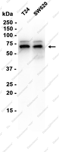 Recombinant S6K1 Monoclonal Antibody - 3