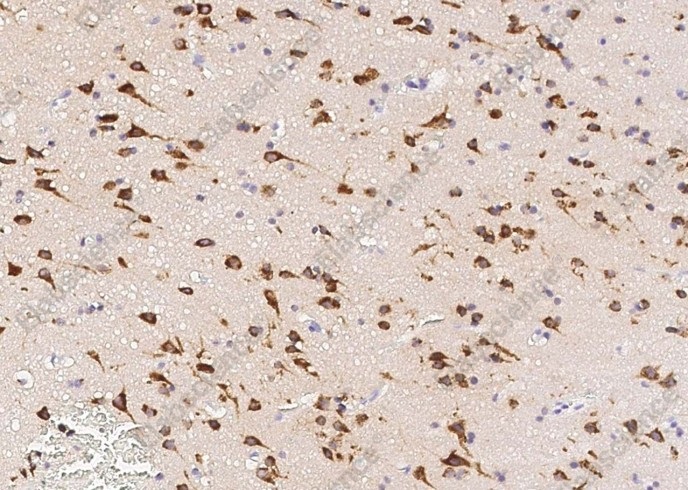 Neuroserpin/SerpinI1 Monoclonal Antibody - 1