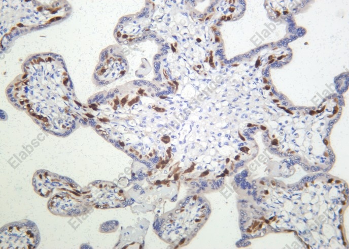 Recombinant FoxO4 Monoclonal Antibody - 2
