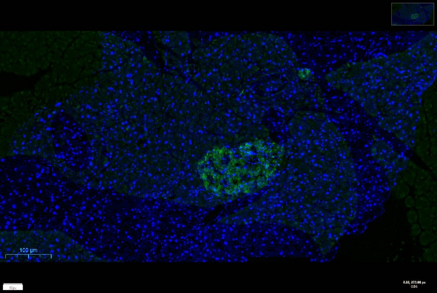 Recombinant Chromogranin A/CHGA/CGA Monoclonal Antibody - small - 9