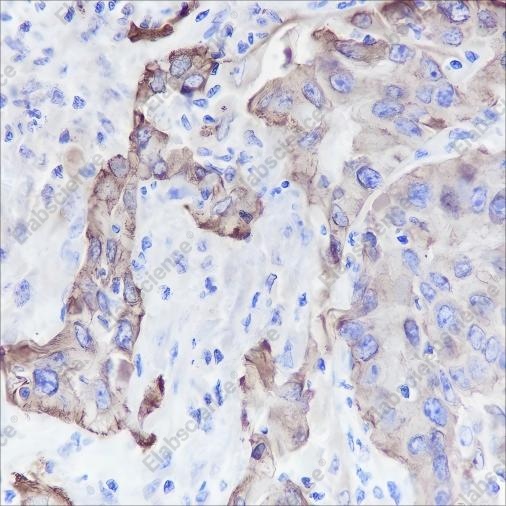 Recombinant Keratin 5/6 Monoclonal Antibody - 4