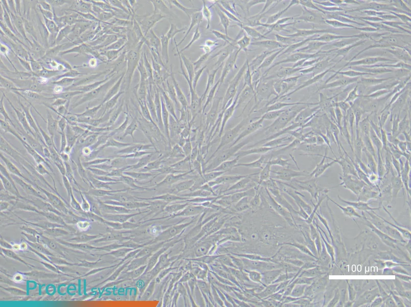 Human Coronary Artery Smooth Muscle Cell Complete MediumHuman Coronary Artery Smooth Muscle Cell Complete Medium - 3