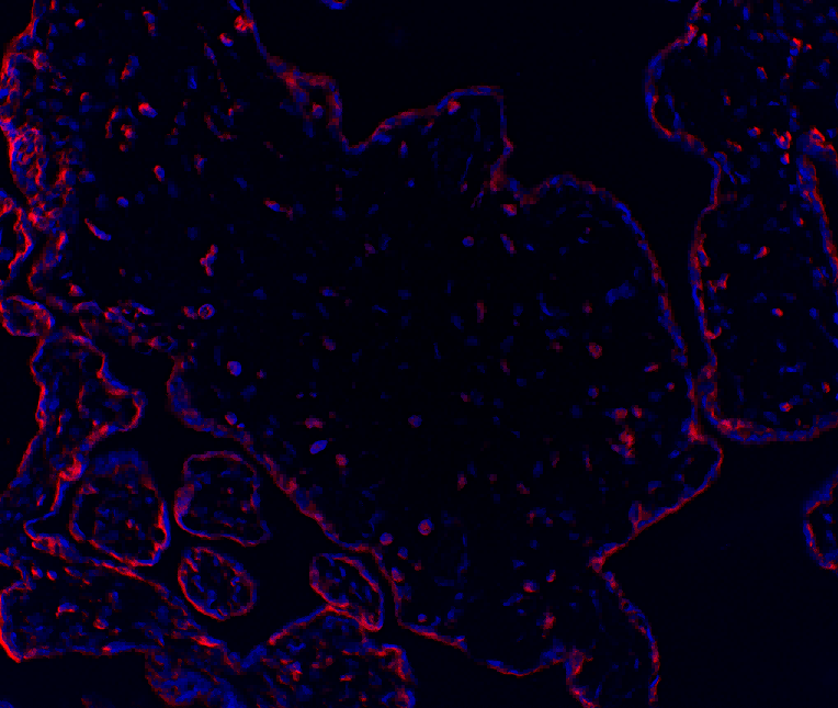 Recombinant PI3-Kinase p85 α Monoclonal Antibody - small - 6