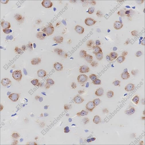 Recombinant eIF3B Monoclonal Antibody - 4