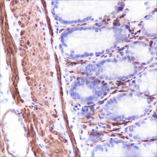 Recombinant Caldesmon/CDM Monoclonal Antibody - 3