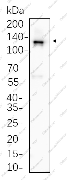 Recombinant Vinculin Monoclonal Antibody - 1