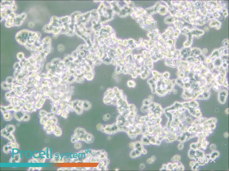 WERI-Rb-1 Cell Complete Medium - 5