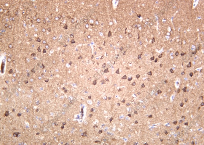 Recombinant GluR-2 Monoclonal Antibody - 1