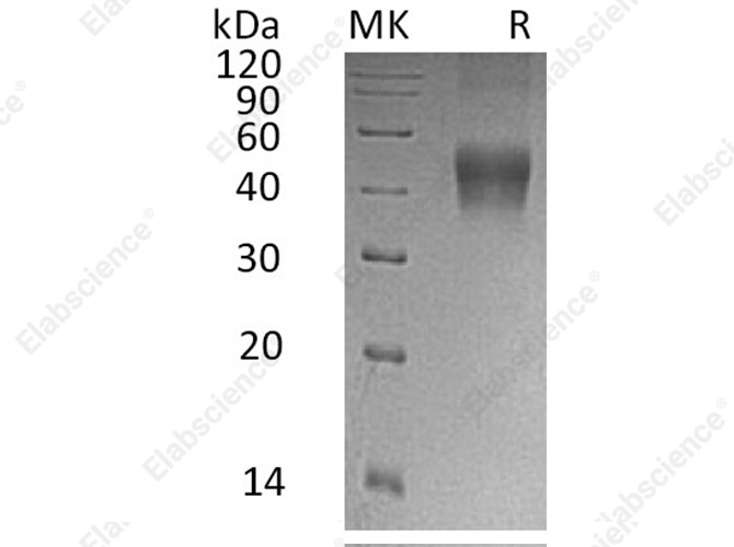 Recombinant Human IL-21R Protein (His Tag) - 1